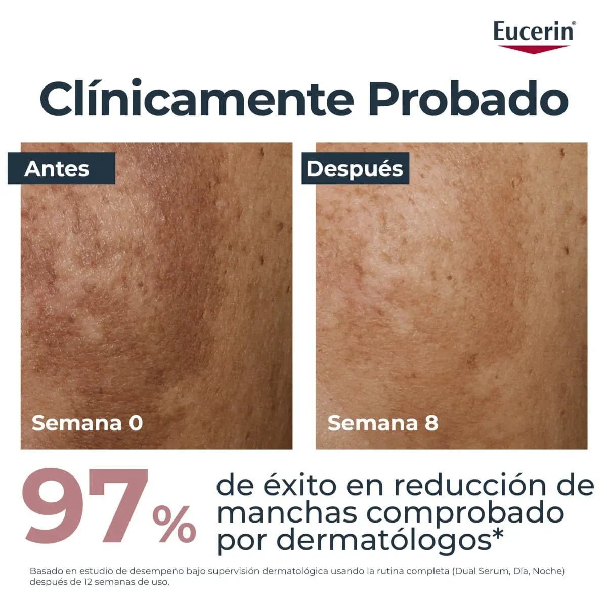 Sérum Eucerin Anti - Pigment Dual 30 ml - TIENDA PIEL